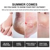 2 Pairs Foot Peel Masks, Foot Mask Callus Remover -