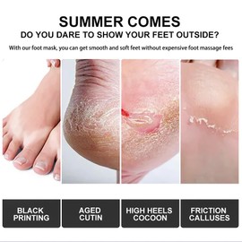 2 Pairs Foot Peel Masks, Foot Mask Callus Remover - Repair Heels, Removes Dry Dead Skin For Baby Soft Feet - Exfoliating Feet Peeling Mask For Hard Skin - Peeling, Lavender