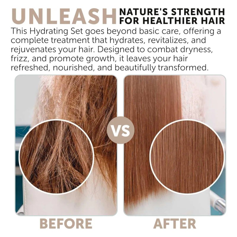 Juego De Champú Y Acondicionador Hidratante De 34 Oz Para