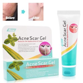 Scar Removal,Acne Scar Removal Gel,Treatment for Face,Lighten acne marks,moisturizes and brightens skin, balances oil secretion,Natural, Gentle & Effective Pure Natural Plant Extracts(35ml) (green)