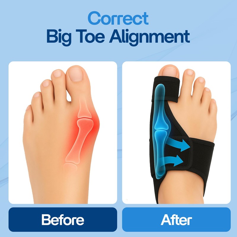 Bunion Corrector for Women & Men (2 Pack) Hammer Toe