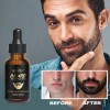 30ml Aceite Con Biotina Y Cafeína Para Crecimiento De Barba