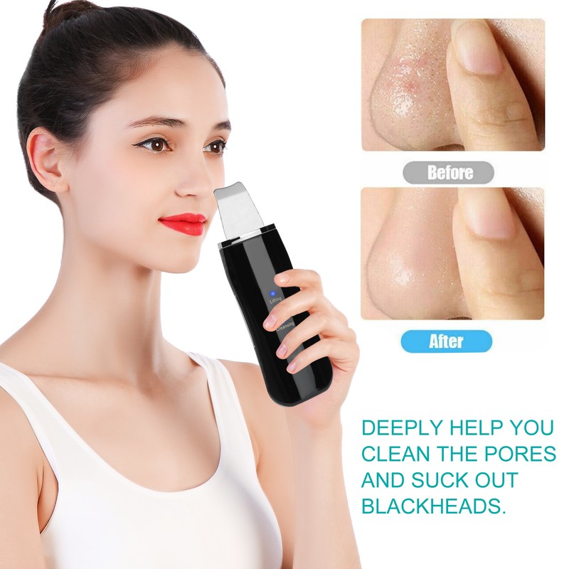 Face Skin Scrubber USB Rechargeable Peeling Machine Ultrasonic Exfoliating SkinCare(Black