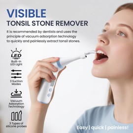 Tonsil Stone Remover with Camera,Electronic Tonsil Stone Removal Kit with LED Light,3 Suction Levels,Fight Bad Breath,Tonsil Stone Vacuum,USB Rechargeable,Christmas Birthday Gifts Mom,Dad,Husband
