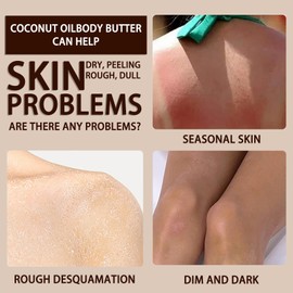 200g Coconut Body Butter - Body Cream For Women - Hydrating Lotion For Dry Skin - Moisturizer With Coconut Oil - Smooth, Improve Skin Texture