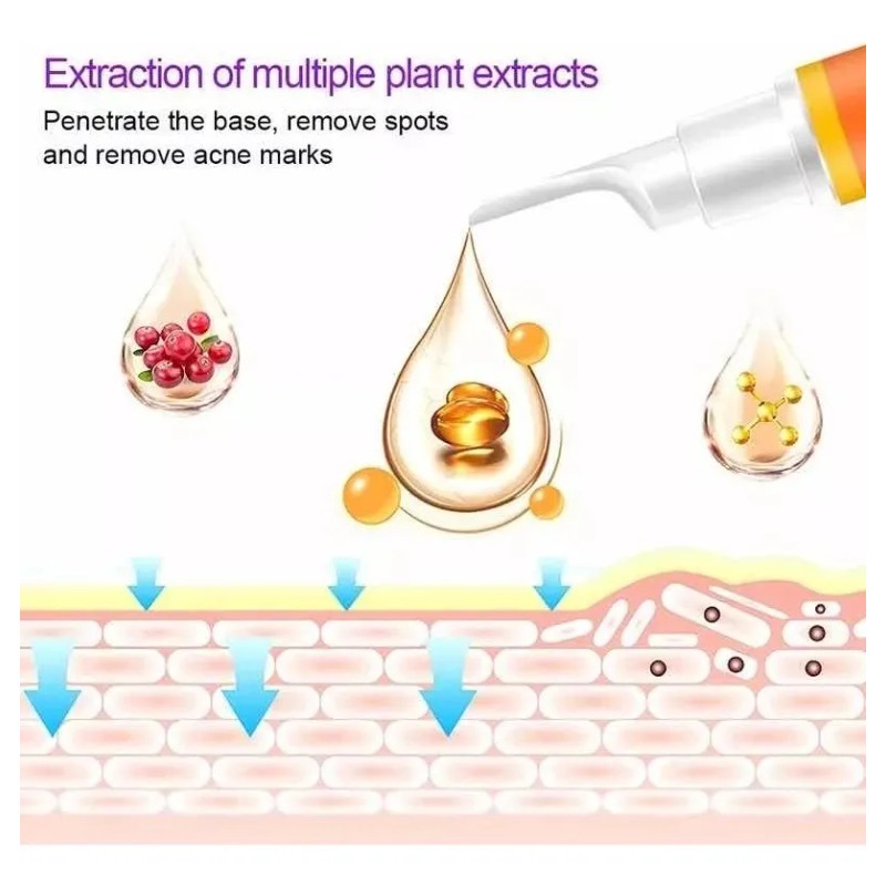 Crema Elimina Manchas De Acné De Sol Pecas Paño Melasma
