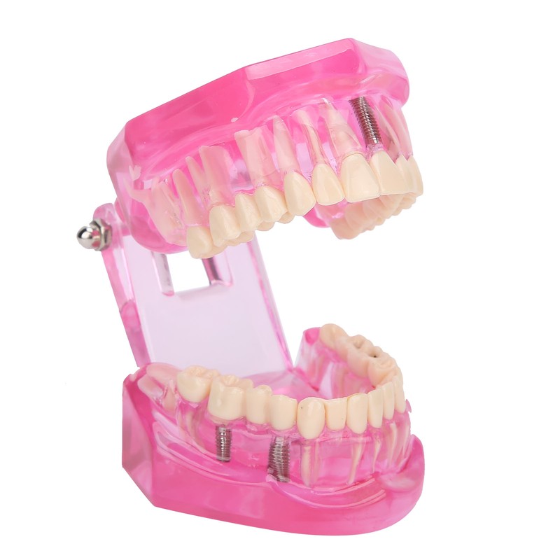 Transparent Adult Teeth Model Pathological Repair Studying Dental Teaching Tools