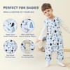 WONDAY 2 Pack Toddler Sleep Sack with Legs, Sleep Sack