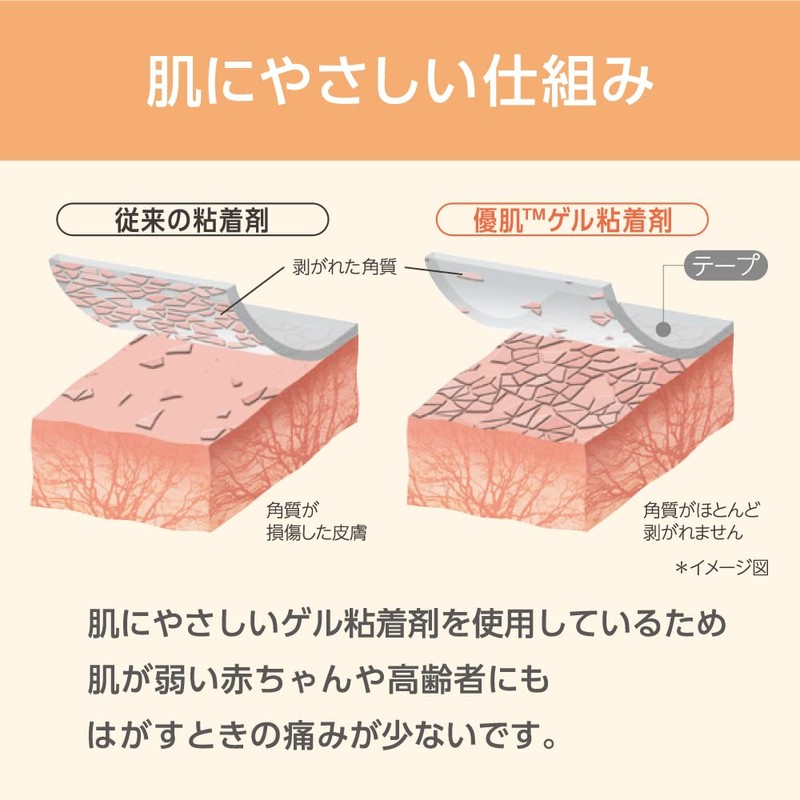 Nitoms YU-KI BAN 3255 Non-Woven Fabric (Skin), 2.0 inches x