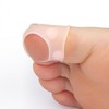 Ingrown toenail cover Prevent ingrown toenails cover 2P RD-12634 4ea
