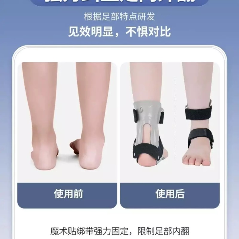 족하수 반장그레이 개 발목 풋 오른발국산 보행 [A. 왼발 국산