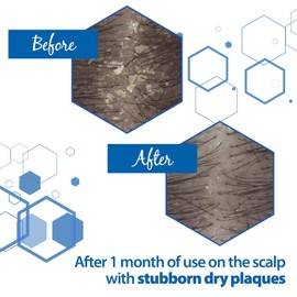 Ducray Kertyol PSO Rebalancing Shampoo 200mL