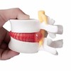 BoNew 1:1.5 Anatomical Human Lumbar Vertebrae Degenerative Lumbar Human Spine