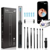 Smart Visual Ear Cleaning Tool Set – HD Camera Earwax