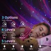 Mycket Starry Sky Projector Night Light, 4 in 1 Aurora