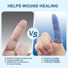 Dimora Finger Cots - Medium Size Protective Covers for Wound