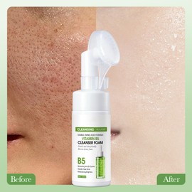 Rostblant face Gesichtsreinigungsschaum, Gesichtsbehandlungsschaum, feuchtigkeitsspendender Gesichtsreinigungsschaum für normale und Mischhaut Porenreinigende Gesichtsreinigung