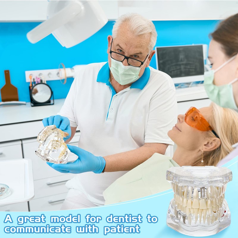 Outus Disease Teeth Model Dental Typodonts Implant Teeth Model with