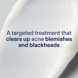 Skinfix 2% BHA Spot Treatment - 0.5 fl oz - Clears Acne Blemishes & Blackheads - Fragrance Free - Vegan, Cruelty Free