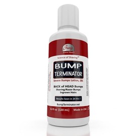 BREEJ BUMP TERMINATOR Severe Bumps Treatment | Razor Bumps And Ingrown Hair Treatment | Bikini Bumps | Back of Head Bumps And Ingrown Hair Treatment, 4 oz (Pack of 1)