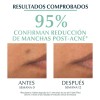 Eucerin Dermopure Serum Triple Efecto 40ml Grasa Día/noche Grasa Día/noche
