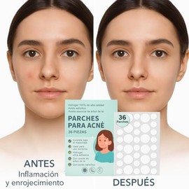 Parches para Acné 36 Piezas – Hidrocoloide con Ácido Salicílico y Árbol de Té, Invisibles Bajo Maquillaje, Ultrafinos, Antiespinillas y Granitos – Uso