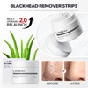 LANBENA Blackhead Remover - Peel Off Mask for Nose &