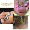 Anself Professional Ingrown Toenail Correction Toenail Treatment Pedicure Tool