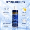 Ketoconazole 1% Anti-Dandruff Shampoo Itchy Scalp Flake Control 200ml
