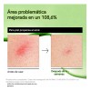 2pcssuero Antienrojecimiento Con Ácido Azelaico Todo Tipo De Piel DíanocheMynorcal
