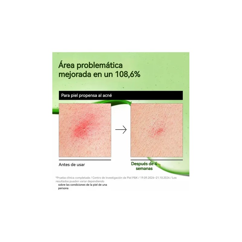 2pcssuero Antienrojecimiento Con Ácido Azelaico Todo Tipo De Piel DíanocheMynorcal