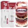 MS.Dear 2PCS Super Probiotic SP-6 Toothpaste, Probiotics Bright White Toothpaste,