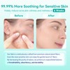 Face Towels, 10"×12" Disposable Face Towel, Face Towelettes XL, Ultra