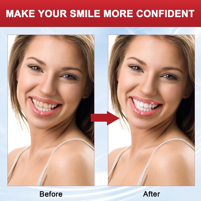 SP-8 Probiotic Toothpaste, SP8 Toothpaste Fresh Breath, Deep Cleaning Care