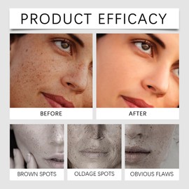 Dark Spot Correcting Glow Serum for Face,Dark Spo-t Corrector,Dark Spot Remover with Kojic Acid,Reduce Sun Spots, Age Spots & Hyperpigmentation for All Skin,Lightweight, Hydrating Glow Booster Serum