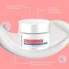 Crema Para Eliminar Las Manchas Para Eliminar Las Manchas De