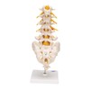 3B Scientific A76/5 Lumbar Spinal Column with Dorso-Lateral Prolapsed Intervertebral