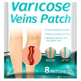 Parche para Aliviar el Dolor de Venas Varicosas y Varices Crónicas