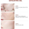 Purifying Exfoliating Gel,Purifying Enzymes Exfoliating Gel,Gentle Deep Cleanser For All