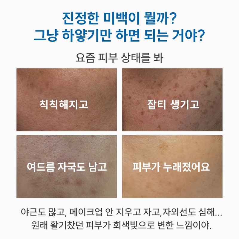 Top-Rated Cream for Dark Spots and Melasma - Bifida Ferment