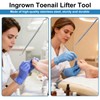 (30+2) Pack Ingrown Toenail Correction Treatment Kit, 30PCS Ingrown Toenails