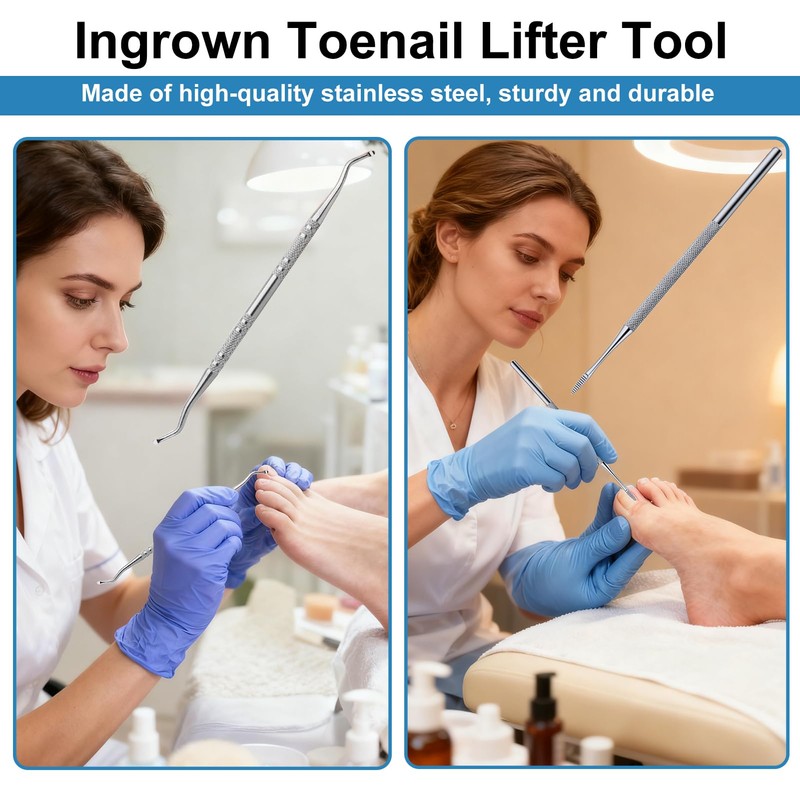 (30+2) Pack Ingrown Toenail Correction Treatment Kit, 30PCS Ingrown Toenails
