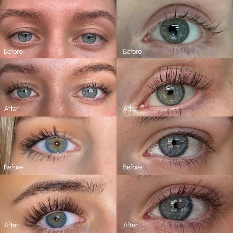 ByBabes Lash CEO Eyelash Growth Serum | Prostaglandin-Free Rapid Brow