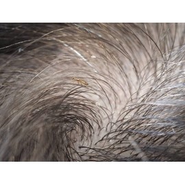 Pharma Läuse-Shampoo, Behandlung gegen Läuse & Langsamkeit. 100 % auf Basis natürlicher Wirkstoffe. Shampoo reinigt und entfernt 200 ml.