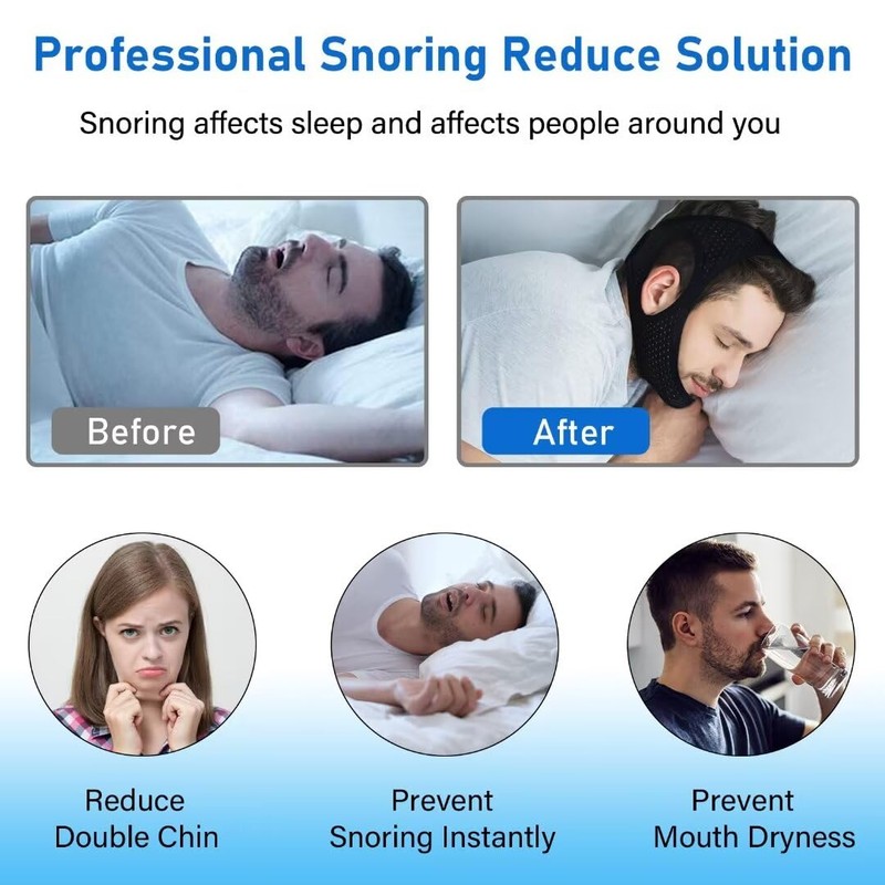 Forzacx Anti Snore Chin Strap - Breathable Chin Strap Snoring