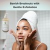 Clear Skin AHA/BHA Exfoliating Cleanser (8 oz) - Gentle Acne