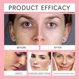 Jelly Mask,Jelly Face Mask,Mask,Jelly Mask For Face,Rose Smoothing Facial Mask,Powder Face Mask,Face Masks Beauty,Face Masks Skincare,Deep Cleansing Hydrating,(Rose Hyaluronic Acid)