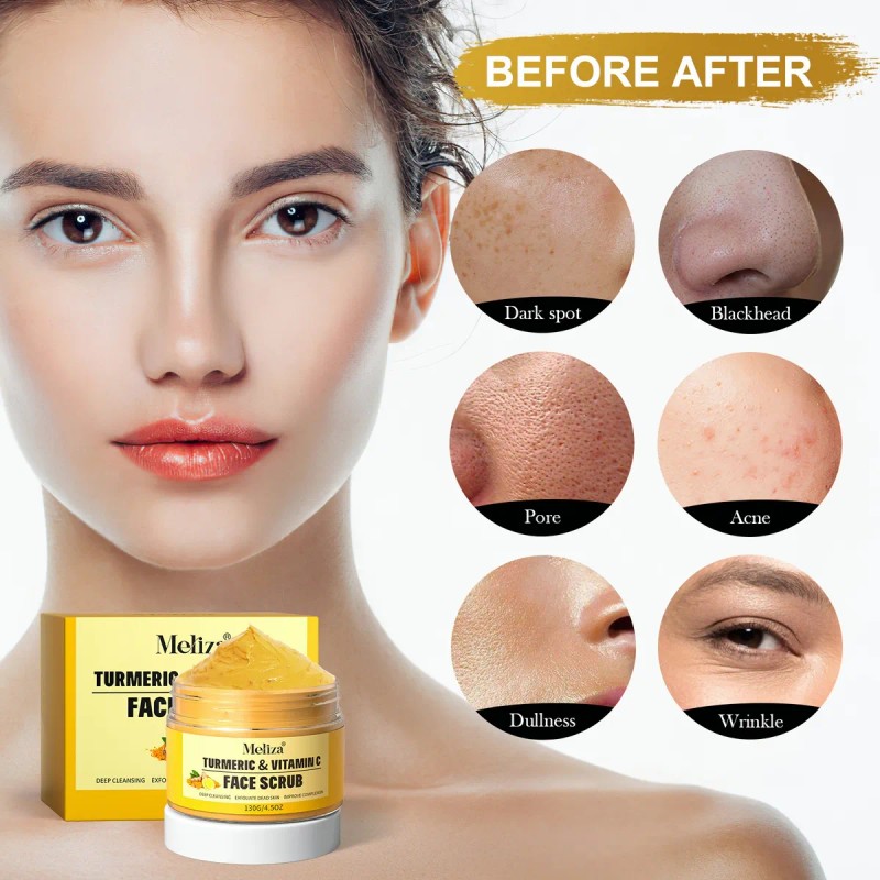 130g Turmeric Vc Facial Scrub,exfoliating Clears Blackheads
