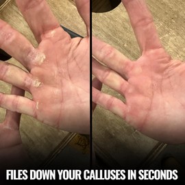 SandBar Original Callus File - Callus Remover for Hands and Fingers - Don't Remove Hard Skin with Shavers Or Pumice Stones - Maintain Your Grip - for Gym Enthusiasts, Climbers, Gymnasts & WOD Junkies