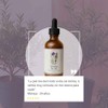 Nae Sérum Niacinamida Árbol de Té | Control de Grasa